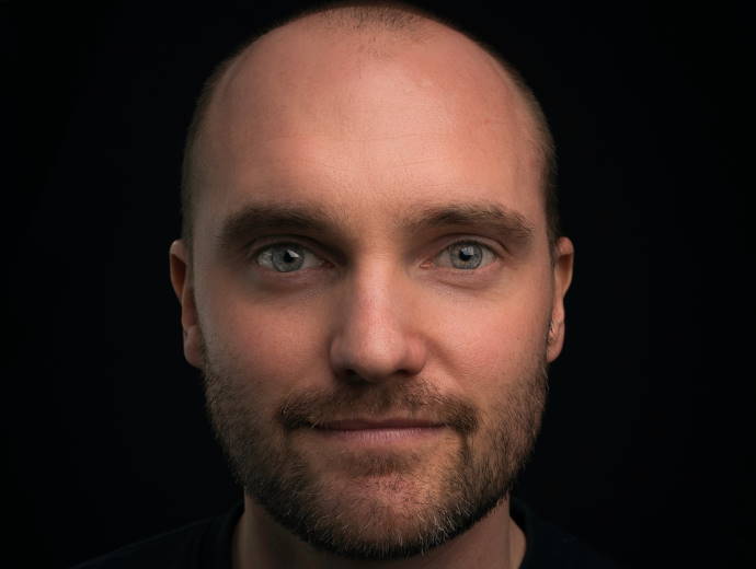 Research suggests a new chemical may provide a permanent solution to male pattern baldness